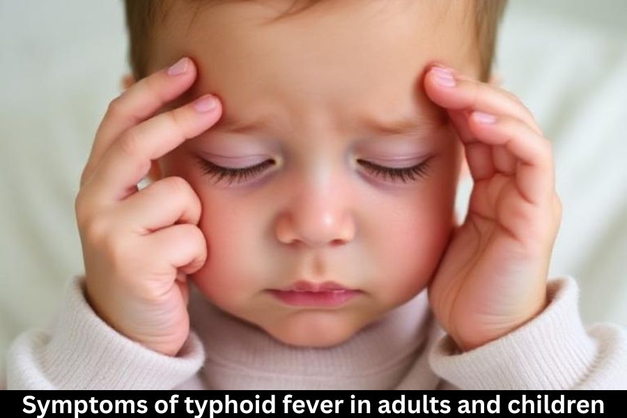 Symptoms of typhoid fever in adults and children